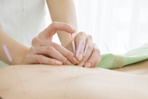 Acupuncture and Digestive Problems