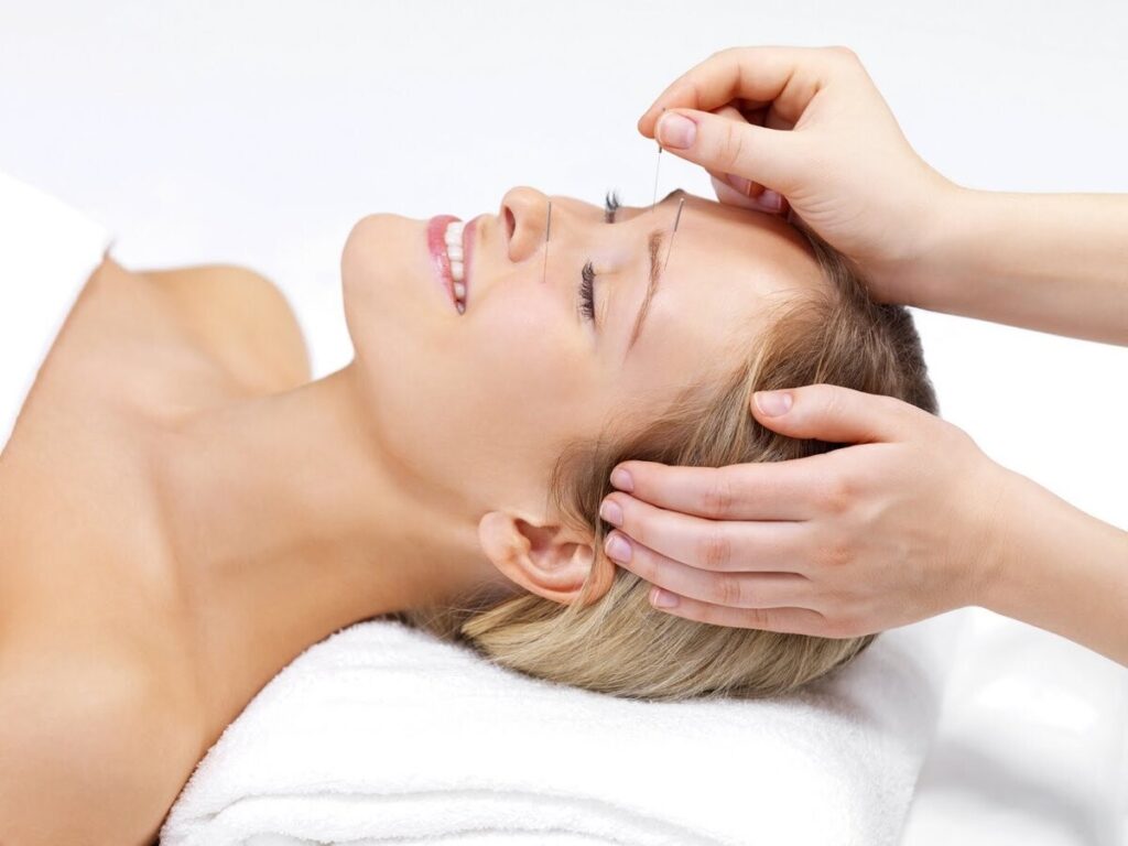 Facial Acupuncture Milton Keynes